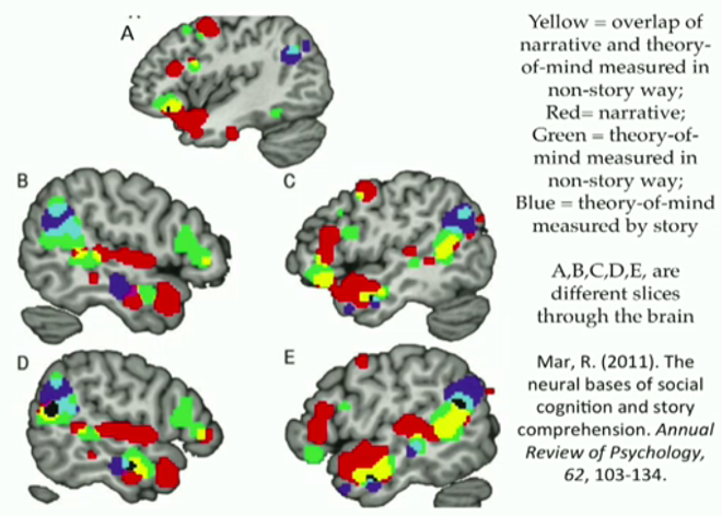 Brain MRI